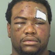 Byron Harris’s mug shot from the night he was beaten (Boynton Beach, Fla., Police)
